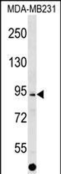 ALS2CL Antibody (Center)