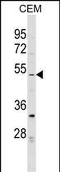 EVI2B Antibody (Center)