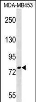 PNPT1 Antibody (Center)