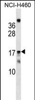 MRPS11 Antibody (Center)