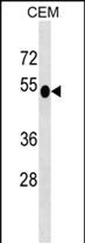 DUSP6 Antibody (N-term)