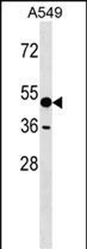 AMY1A Antibody (C-term)