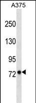 LRFN2 Antibody (C-term)