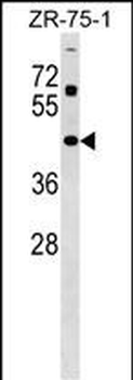 ZNF323 Antibody (Center)