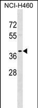 TPM2 Antibody (C-term)