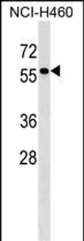 TYRP1 Antibody (Center)