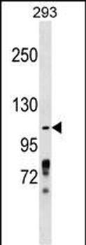 ZBTB4 Antibody (Center)