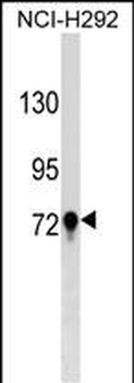 TGM3 Antibody (C-term)