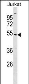 UBE2Q1 Antibody (N-term)