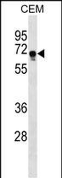 FEM1C Antibody (C-term)