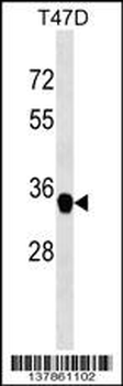 FAM164A Antibody (C-term)