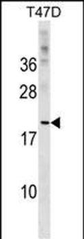 CLEC4D Antibody (Center)