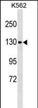 CHERP Antibody (C-term)