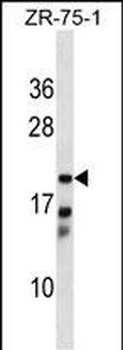CBR4 Antibody (C-term)