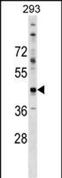 CADM2 Antibody (N-term)