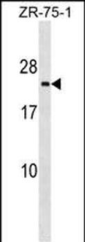 TMED3 Antibody (C-term)