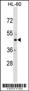 CHST10 Antibody (C-term)