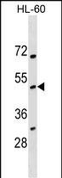 NOXO1 Antibody (Center)
