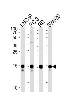 TCEAL1 Antibody (N-term)