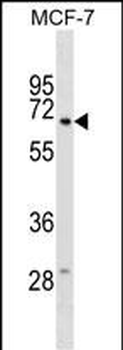 GGT6 Antibody (N-term)