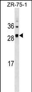 SPC25 Antibody (Center)