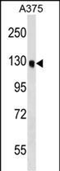 OSBPL6 Antibody (C-term)