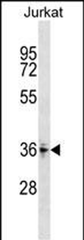 ZNF346 Antibody (Center)