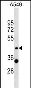 ZNF19 Antibody (N-term)