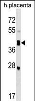SMOC2 Antibody (C-term)