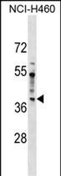 SDCCAG8 Antibody (N-term)