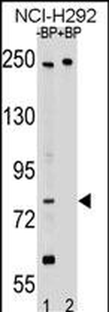 APPL2 Antibody (N-term)