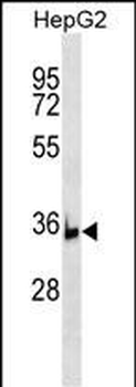 BRIX1 Antibody (C-term)