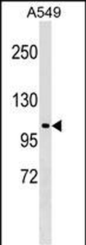 HECTD3 Antibody (C-term)