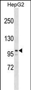 ARID5B Antibody (Center)