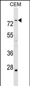 ABLIM3 Antibody (C-term)