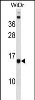 DAD1 Antibody (C-term)