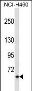 CLCNKA Antibody (N-term)