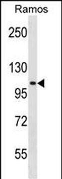 TACC1 Antibody (N-term)