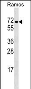 RBPJ Antibody (N-term)