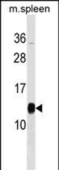 PFDN1 Antibody (C-term)