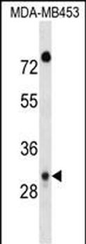 DAPP1 Antibody (C-term)