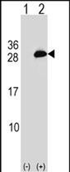 UBE2T Antibody (C-term)