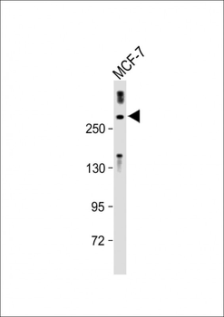 TET2 Antibody (N-term)
