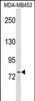 POMT2 Antibody (C-term)