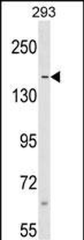 SAFB Antibody (N-term)
