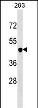 TNFRSF25 Antibody (Center)