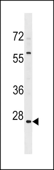 HMGN5 Antibody (N-term)