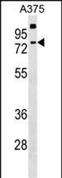 TKTL2 Antibody (N-term)