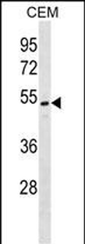ONECUT2 Antibody (N-term)