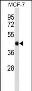 IER5 Antibody (Center)